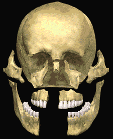 Facial Trauma Illustration San Antonio TX